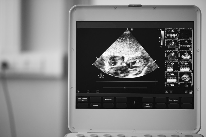 Use a Top Company Offering a Used Ultrasound Machine for Sale