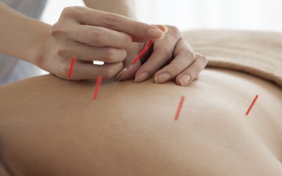 Finding Personalized Acupuncture Care for Common Health Needs